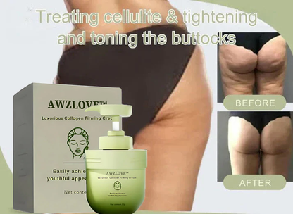 Awzlove™ Luxurious Collagen Firming Cream(🔥70% Off for a Limited Time!)🐋